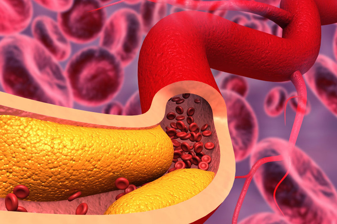 How to choose a Vascular Surgeon? Dr. Eitan Heldenberg